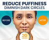 Marine Collagen Under-Eye Patches with Vitamin C & Hyaluronic Acid 30 Pairs