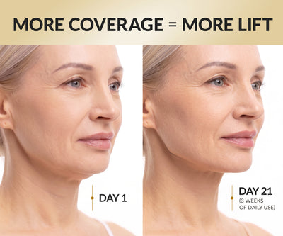 Stylia Chin & Neck Lifting Collagen Mask with PDRN & 24K Gold - Neck Firming and Tightening Mask, Hydrogel Neck Wrinkle Patches & Chin Lifting Mask for Women - Double Chin, Jowls & Jawline, 10 Pcs